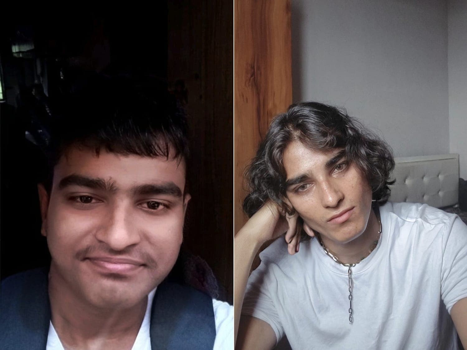 Before and after facial aesthetics results