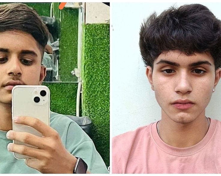 Before and after facial aesthetics results