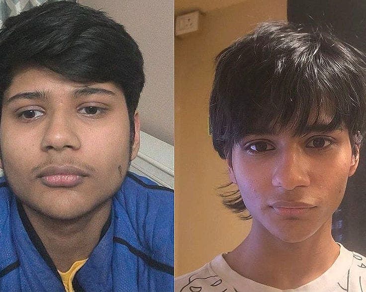 Before and after facial aesthetics results