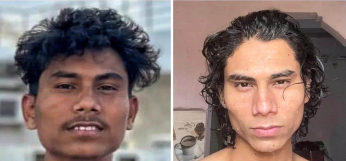 Before and after facial aesthetics results